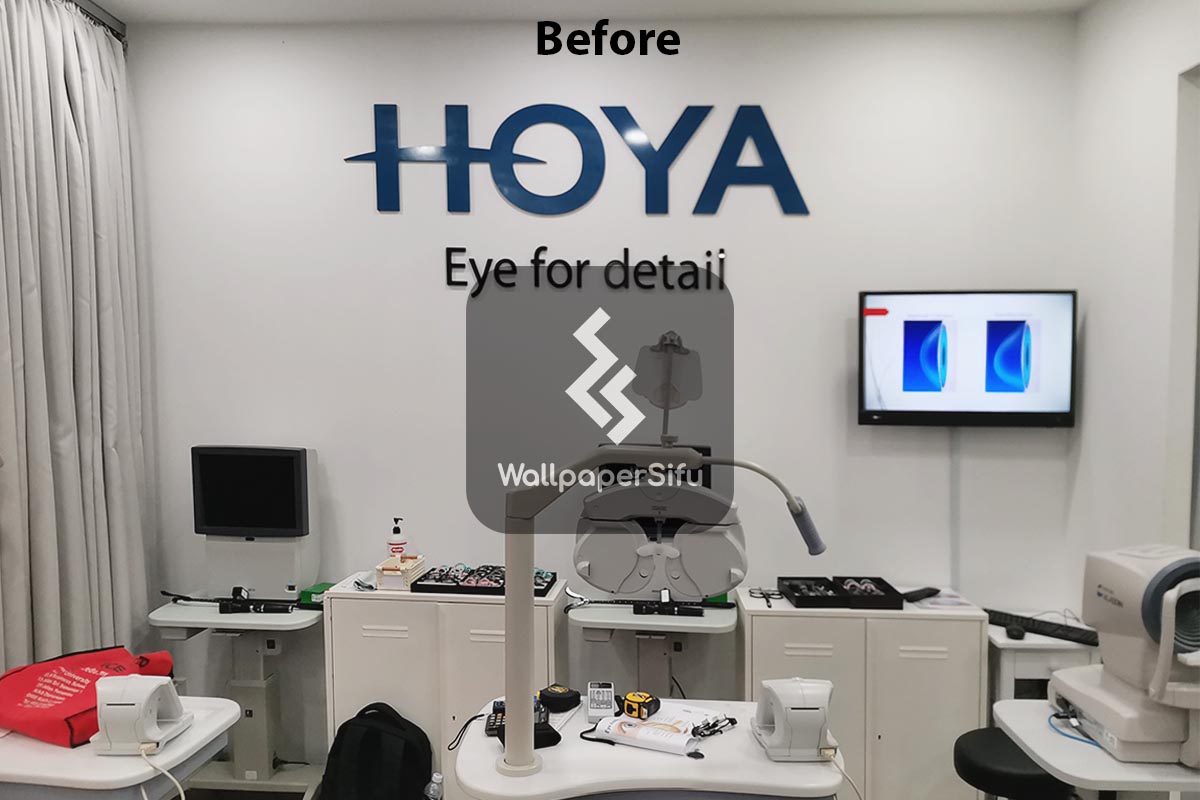 Eye Anatomy Bangi